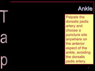 Ankle 
Palpate the dorsalis pedis artery and choose a puncture site anywhere on the anterior aspect of the ankle, avoiding the dorsalis pedis artery. 
53  