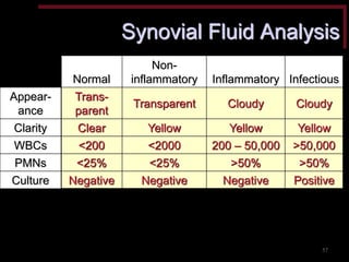 Normal 
Non- inflammatory 
Inflammatory 
Infectious 
Trans- parent 
Transparent 
Cloudy 
Cloudy 
Clear 
Yellow 
Yellow 
Yellow 
<200 
<2000 
200 – 50,000 
>50,000 
<25% 
<25% 
>50% 
>50% 
Negative 
Negative 
Negative 
Positive 
Appear- ance 
Clarity 
WBCs 
PMNs 
Culture 
Synovial Fluid Analysis 
57  