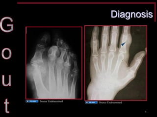 Diagnosis 
81 
Source Undetermined 
Source Undetermined  