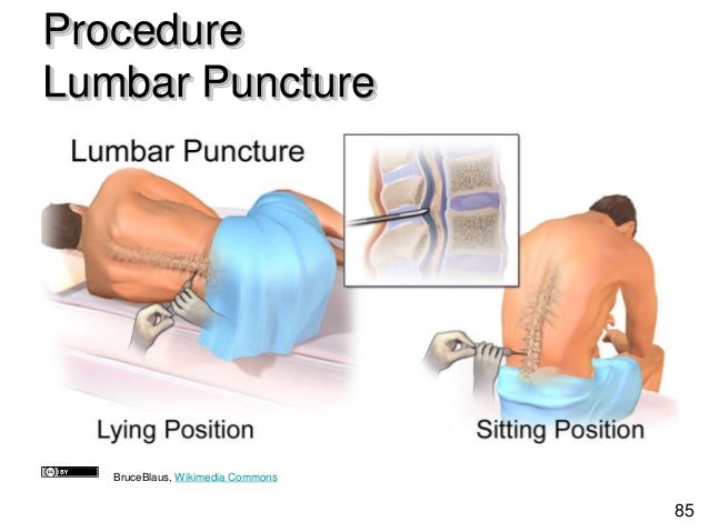 Lp Procedure Guide V23 Basic Skills - ST