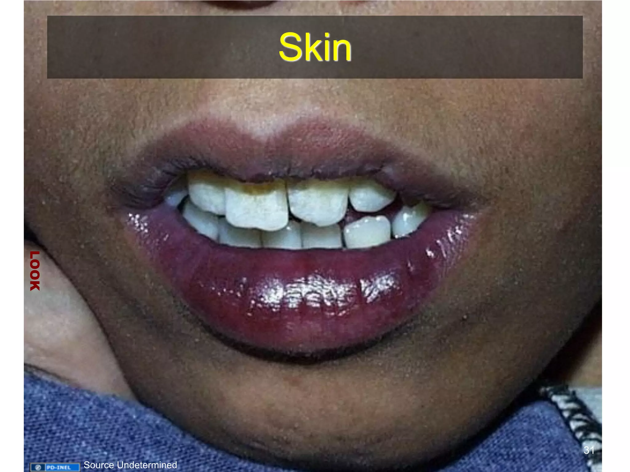 Skin 
LOOK 
31 
Source Undetermined 
 