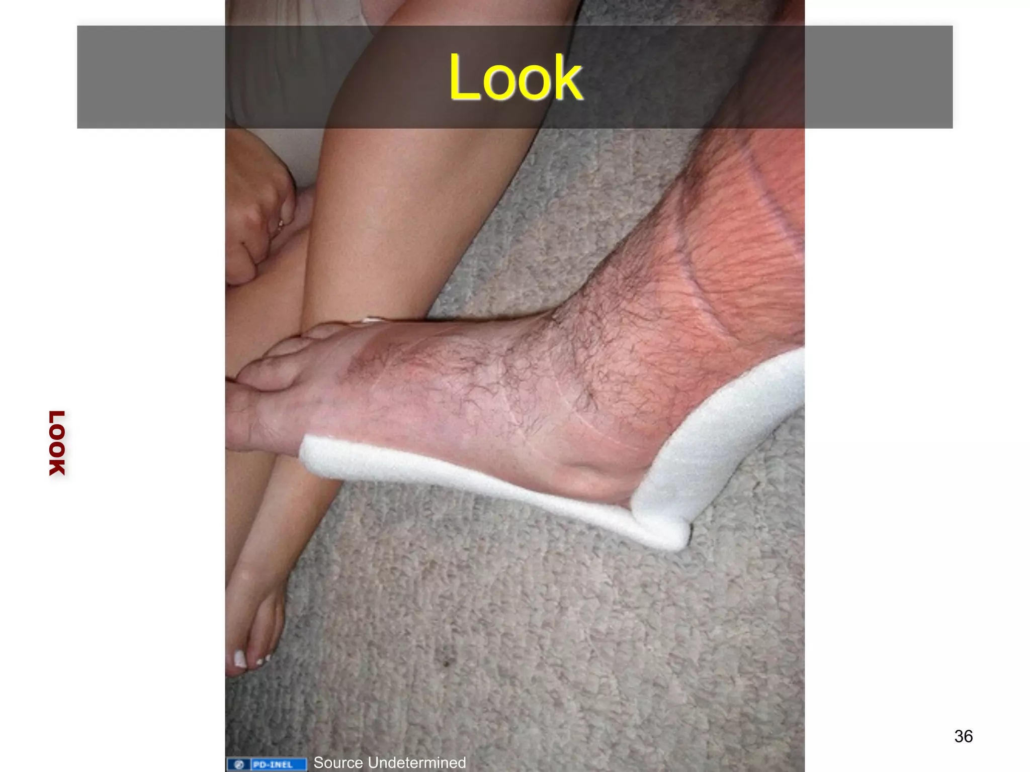 Look 
LOOK 
36 
Source Undetermined 
 