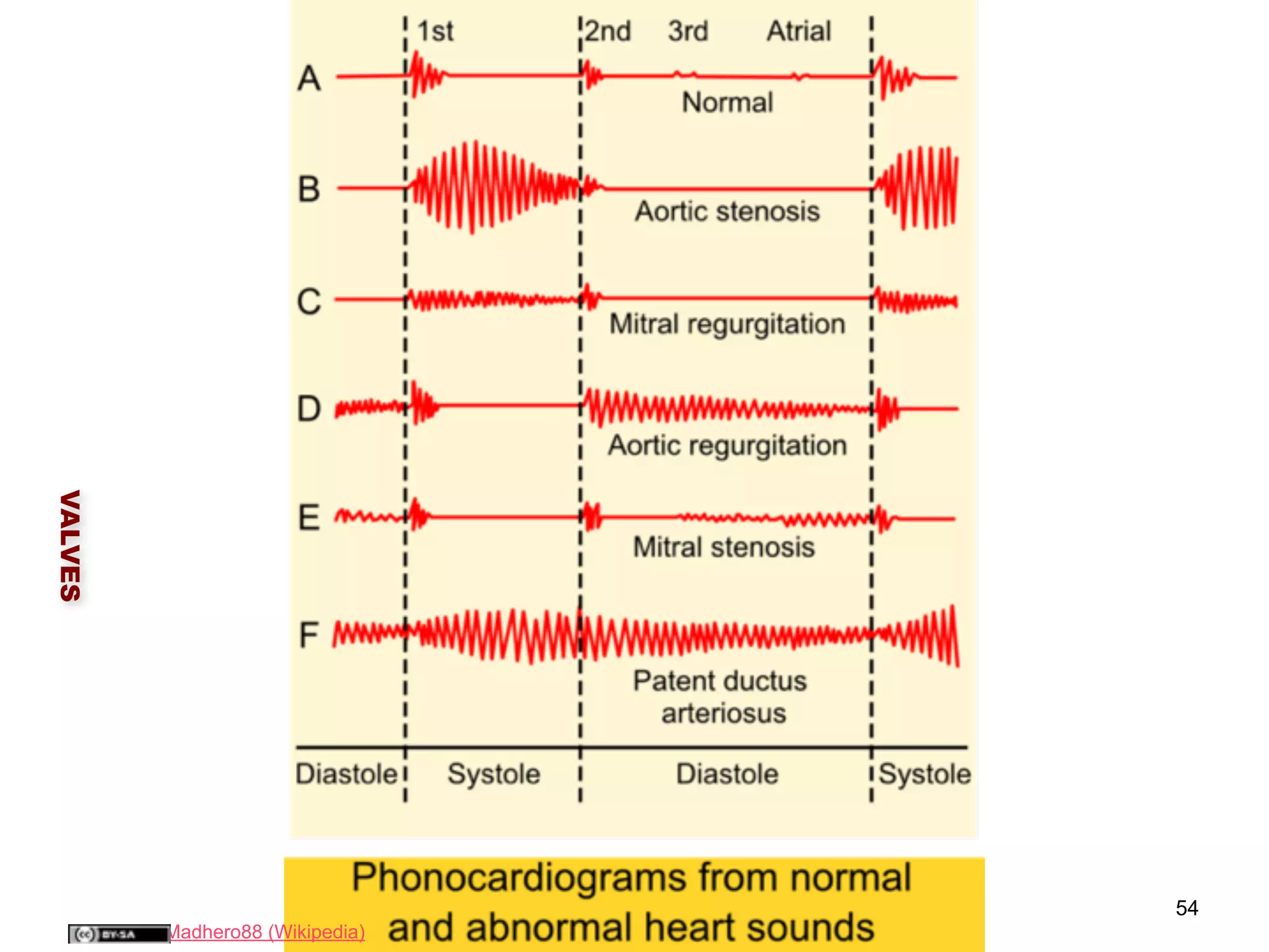 VALVES 
54 
Madhero88 (Wikipedia) 
 