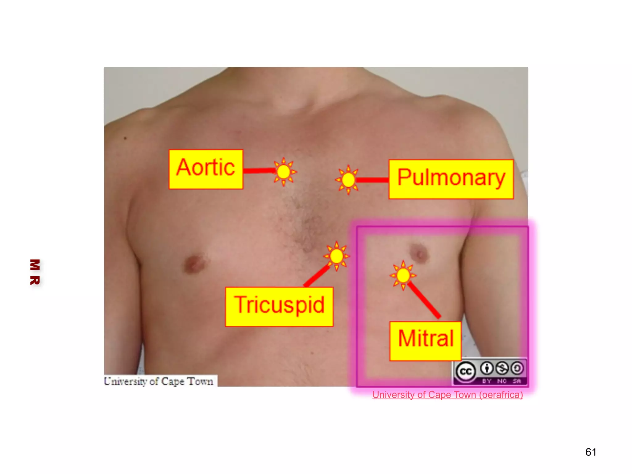 M R 
61 
University of Cape Town (oerafrica) 
 