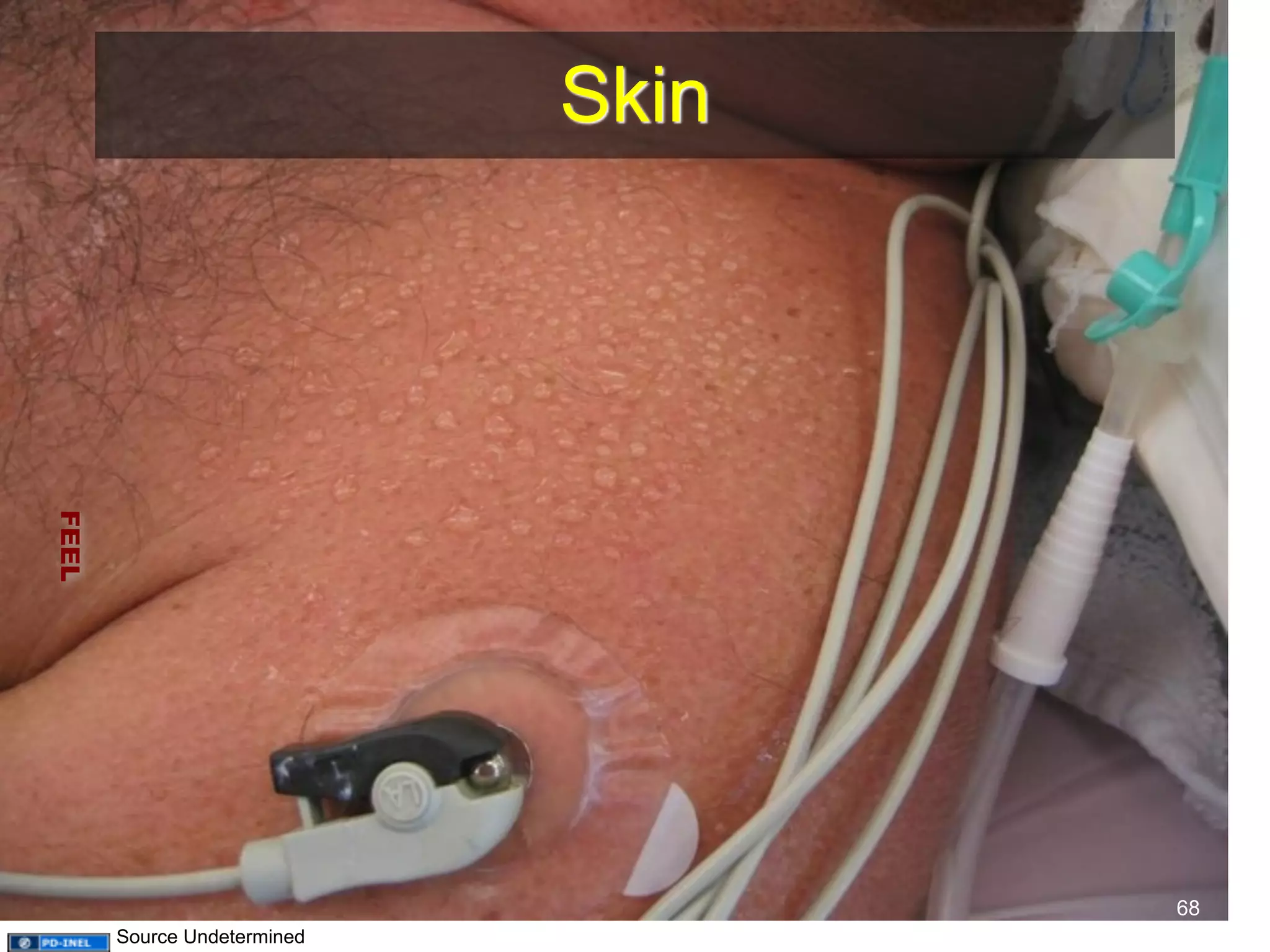 Skin 
FEEL 
68 
Source Undetermined 
 