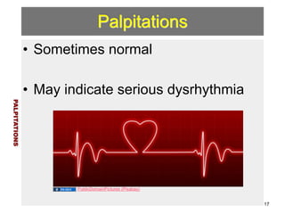 Palpitations 
• Sometimes normal 
! 
• May indicate serious dysrhythmia 
PALPITATIONS 
17 
PublicDomainPictures (Pixabay) 
 