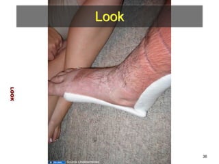 Look 
LOOK 
36 
Source Undetermined 
 