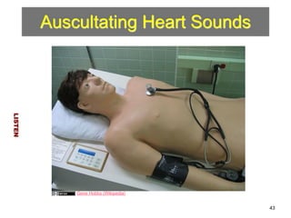 Auscultating Heart Sounds 
LISTEN 
43 
Gene Hobbs (Wikipedia) 
 
