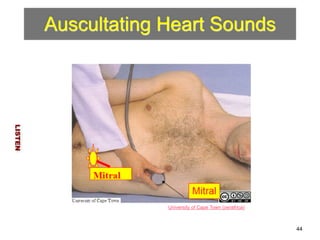 Auscultating Heart Sounds 
LISTEN 
44 
University of Cape Town (oerafrica) 
 