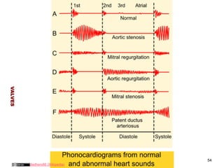 VALVES 
54 
Madhero88 (Wikipedia) 
 