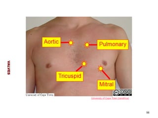 VALVES 
56 
University of Cape Town (oerafrica) 
 