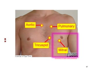 M R 
61 
University of Cape Town (oerafrica) 
 