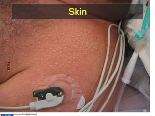 Skin 
FEEL 
68 
Source Undetermined 
 