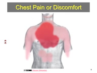 Chest Pain or Discomfort 
C C 
JHeuser (Wikipedia) 8 
 
