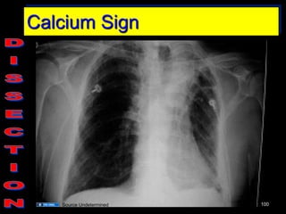 GEMC- Cardiovascular Board Review Session 1- Resident Training | PDF