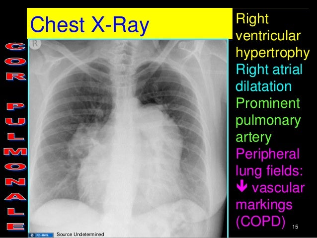 GEMC- Cardiovascular Board Review Session 2- Resident Training
