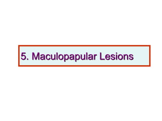 5. Maculopapular Lesions
 