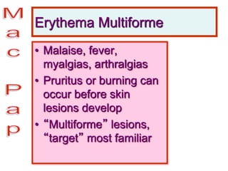 Erythema Multiforme
• Malaise, fever,
myalgias, arthralgias
• Pruritus or burning can
occur before skin
lesions develop
• “Multiforme” lesions,
“target” most familiar
 