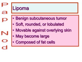 Lipoma
• Benign subcutaneous tumor
• Soft, rounded, or lobulated
• Movable against overlying skin
• May become large
• Composed of fat cells
 