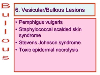 6. Vesicular/Bullous Lesions
• Pemphigus vulgaris
• Staphylococcal scalded skin
syndrome
• Stevens Johnson syndrome
• Toxic epidermal necrolysis
 