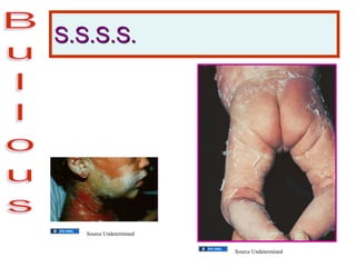 S.S.S.S.
Source Undetermined
Source Undetermined
 