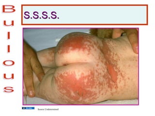 S.S.S.S.
Source Undetermined
 