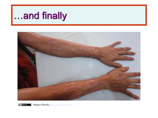 …and finally
Magnus Manske, Wikimedia Commons
 