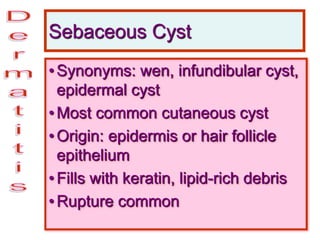 Sebaceous Cyst
•Synonyms: wen, infundibular cyst,
epidermal cyst
•Most common cutaneous cyst
•Origin: epidermis or hair follicle
epithelium
•Fills with keratin, lipid-rich debris
•Rupture common
 