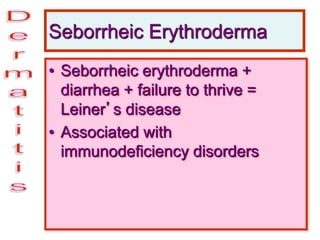 Seborrheic Erythroderma
• Seborrheic erythroderma +
diarrhea + failure to thrive =
Leiner’s disease
• Associated with
immunodeficiency disorders
 
