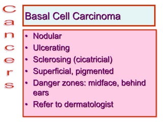 Basal Cell Carcinoma
• Nodular
• Ulcerating
• Sclerosing (cicatricial)
• Superficial, pigmented
• Danger zones: midface, behind
ears
• Refer to dermatologist
 