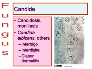 Candida
• Candidosis,
moniliasis
• Candida
albicans, others
–Intertrigo
–Interdigital
–Diaper
dermatitis
GrahamColm,
Wikimedia Commons
 
