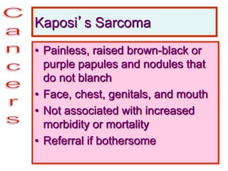 Kaposi’s Sarcoma
• Painless, raised brown-black or
purple papules and nodules that
do not blanch
• Face, chest, genitals, and mouth
• Not associated with increased
morbidity or mortality
• Referral if bothersome
 