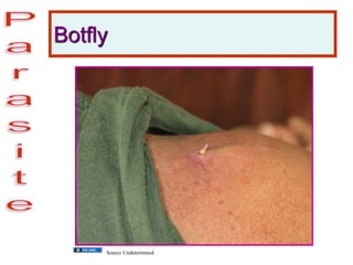 Botfly
Source Undetermined
 