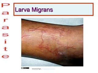 Larva Migrans
Grook da Oger, Wikimedia Commons
 