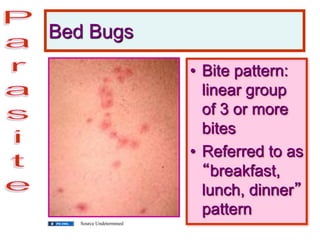 Bed Bugs
• Bite pattern:
linear group
of 3 or more
bites
• Referred to as
“breakfast,
lunch, dinner”
pattern
Source Undetermined
 