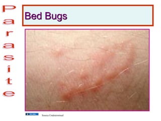 Bed Bugs
Source Undetermined
 