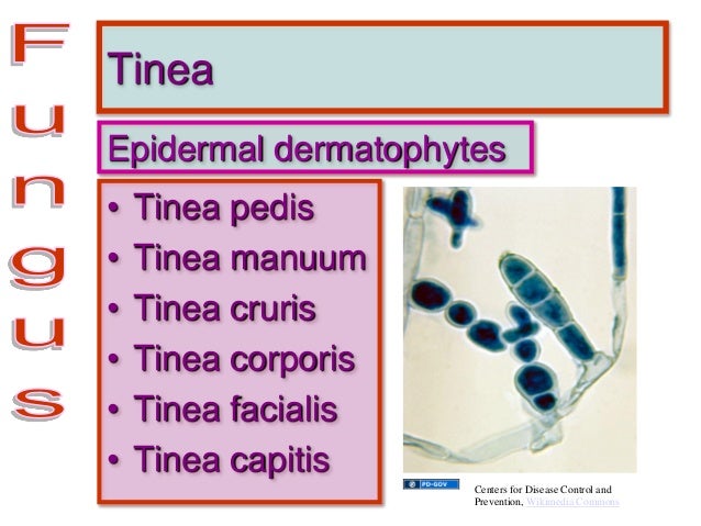 GEMC- Cutaneous Emergency- Resident Training GEMC- Cutaneous Emergency- Resident Training