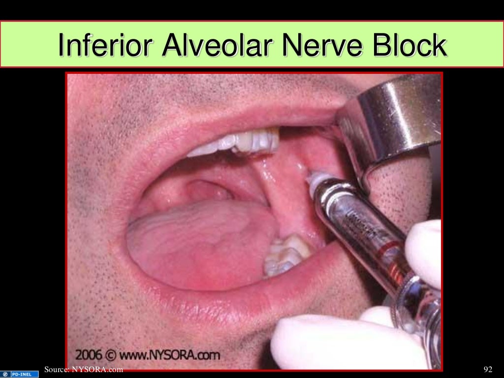 GEMC Dental Emergencies and Common Dental Blocks Resident Training