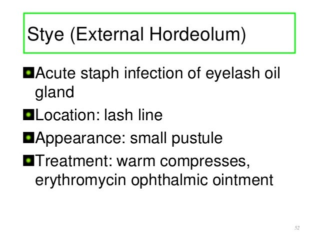 Internal Hordeolum Doxycycline