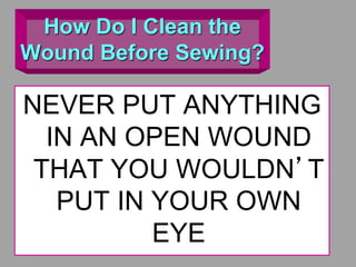 How Do I Clean the
Wound Before Sewing?
NEVER PUT ANYTHING
IN AN OPEN WOUND
THAT YOU WOULDN’T
PUT IN YOUR OWN
EYE
 