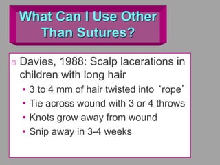 What Can I Use Other
Than Sutures?
Davies, 1988: Scalp lacerations in
children with long hair
• 3 to 4 mm of hair twisted into ‘rope’
• Tie across wound with 3 or 4 throws
• Knots grow away from wound
• Snip away in 3-4 weeks
 
