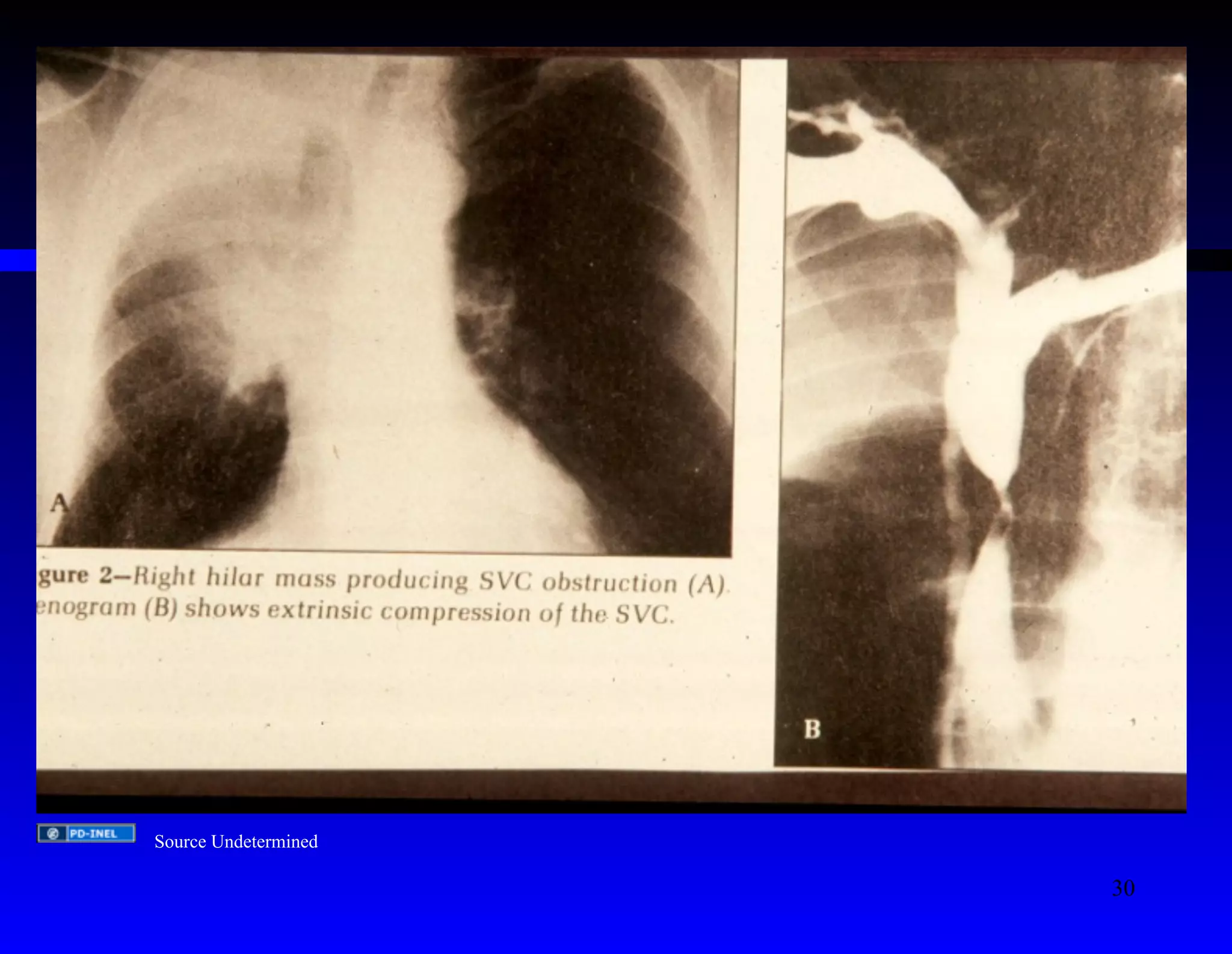 Source Undetermined 
30 
 