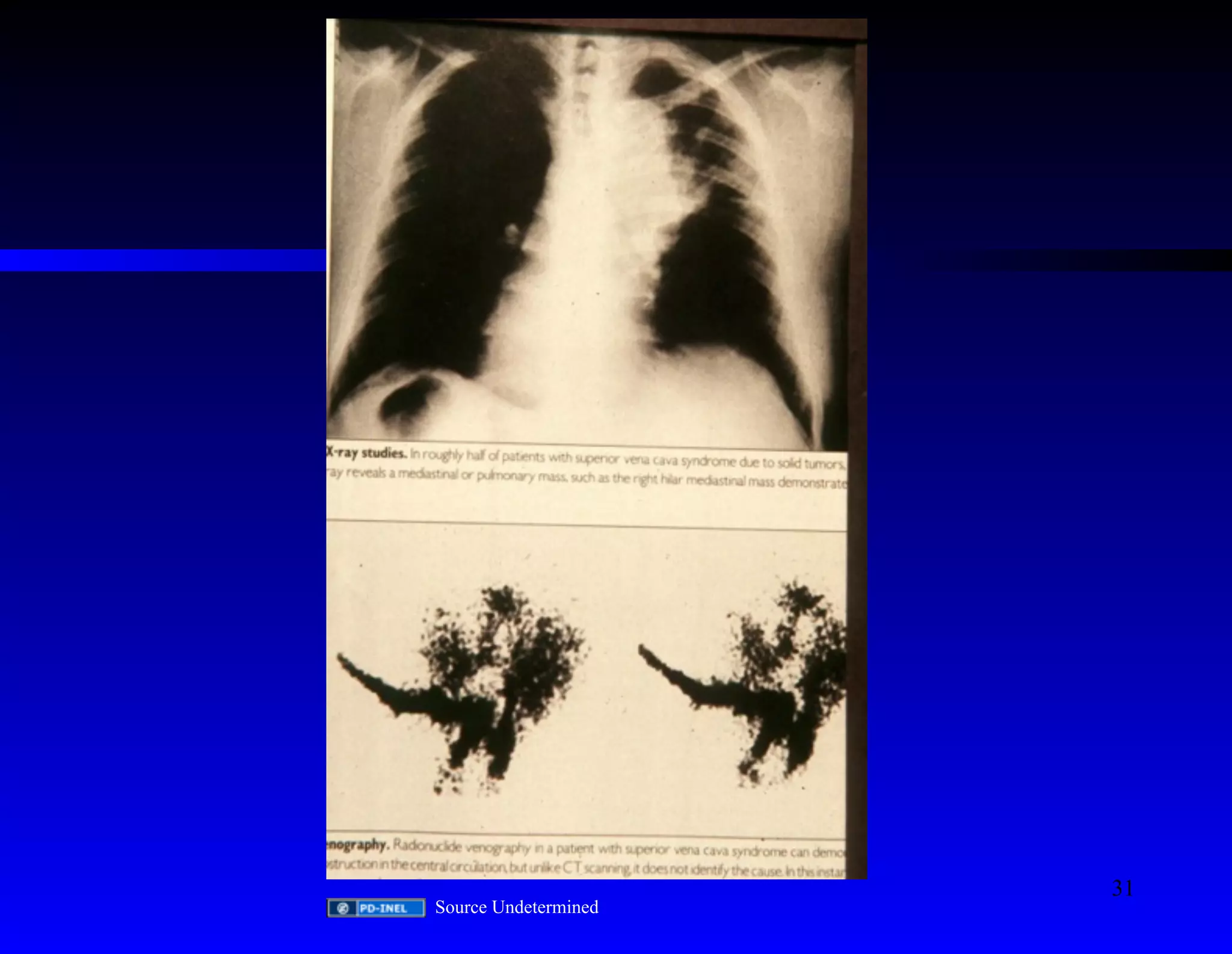 Source Undetermined 
31 
 