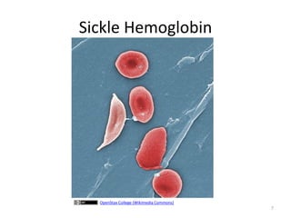 Sickle Hemoglobin
7
OpenStax College (Wikimedia Commons)
 