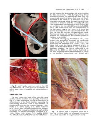 DISCUSSION
The iliac region not only offers favorable bone
quality, but also excellent bone quantity. This makes
the DCIA ﬂap appropriate for the reconstruction of
different parts of the facial skeleton, especially the
load bearing structures, such as the mandible, or
complex structures like the zygoma (Riediger, 1988;
Frodel et al., 1993; Seikaly et al., 2003; Modabber
et al., 2012). Many factors contribute to the success-
ful transfer of a vascularized iliac bone graft, and its
harvesting can be very challenging (Berggren et al.,
1982; Taylor, 1982; Urken, 1991; August, 2000).
The difﬁcult anatomy and donor site morbidity follow-
ing ﬂap harvest play an important role when choosing
the DCIA (Jewer et al., 1988). During our long clinical
experience in using this vascularized bone graft, we
encountered several variations that were not clearly
described in the literature. It stimulated us to this
extensive anatomical study. The awareness of these
variations in anatomy and the knowledge of exact
clinical landmarks are essential to reducing ﬂap fail-
ure and donor site morbidity (Ghassemi et al., 2009,
2012). The absence of a clear and complete map of
the iliac region may be the reason for it being less
popular as compared to the vascularized ﬁbular ﬂap
over the past two decades. The vascularized ﬁbular
ﬂap however does not always offer sufﬁcient bone
material and often requires an additional procedure
(Schleier et al., 2006).
The DCIA was vaguely described in 1892, when
Stieda from Ko¨nigsberg published his remarkable
study searching for the cause of bleeding when
puncturing the abdominal wall (Stieda, 1892). He
called this vessel the lateral epigastric artery. In
1928, Adachi described the DCIA very adequately in
Japanese. However, the clinical importance of the
SCIA and the DCIA was later clearly illustrated as
the main supplying vessel of the bone ﬂap by Taylor
in his excellent experimental and clinical work
Fig. 9. (a,b) Type IV, a common origin of the DCIA
and IEA from the EIA. [Color ﬁgure can be viewed in the
online issue, which is available at wileyonlinelibrary.
com.]
Fig. 10. Classic type Ia originates below the IL
from the FA. [Color ﬁgure can be viewed in the online
issue, which is available at wileyonlinelibrary.com.]
7Anatomy and Topography of DCIA Flap
 