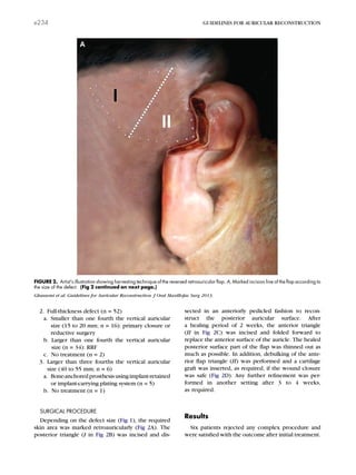 2. Full-thickness defect (n = 52)
a. Smaller than one fourth the vertical auricular
size (15 to 20 mm; n = 16): primary closure or
reductive surgery
b. Larger than one fourth the vertical auricular
size (n = 34): RRF
c. No treatment (n = 2)
3. Larger than three fourths the vertical auricular
size (40 to 55 mm; n = 6)
a. Bone-anchoredprosthesisusingimplant-retained
or implant-carrying plating system (n = 5)
b. No treatment (n = 1)
SURGICAL PROCEDURE
Depending on the defect size (Fig 1), the required
skin area was marked retroauricularly (Fig 2A). The
posterior triangle (I in Fig 2B) was incised and dis-
sected in an anteriorly pedicled fashion to recon-
struct the posterior auricular surface. After
a healing period of 2 weeks, the anterior triangle
(II in Fig 2C) was incised and folded forward to
replace the anterior surface of the auricle. The healed
posterior surface part of the ﬂap was thinned out as
much as possible. In addition, debulking of the ante-
rior ﬂap triangle (II) was performed and a cartilage
graft was inserted, as required, if the wound closure
was safe (Fig 2D). Any further reﬁnement was per-
formed in another setting after 3 to 4 weeks,
as required.
Results
Six patients rejected any complex procedure and
were satisﬁed with the outcome after initial treatment.
FIGURE 2. Artist’s illustration showing harvesting technique of the reversed retroauricular ﬂap. A, Marked incision line of the ﬂap according to
the size of the defect. (Fig 2 continued on next page.)
Ghassemi et al. Guidelines for Auricular Reconstruction. J Oral Maxillofac Surg 2013.
e234 GUIDELINES FOR AURICULAR RECONSTRUCTION
 