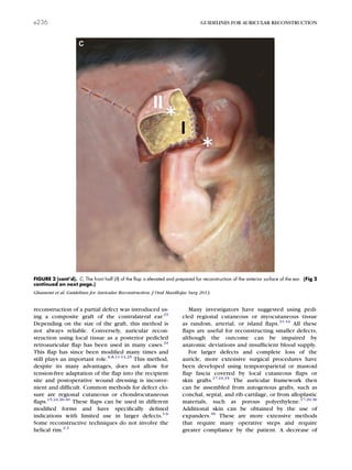 reconstruction of a partial defect was introduced us-
ing a composite graft of the contralateral ear.23
Depending on the size of the graft, this method is
not always reliable. Conversely, auricular recon-
struction using local tissue as a posterior pedicled
retroauricular ﬂap has been used in many cases.24
This ﬂap has since been modiﬁed many times and
still plays an important role.6,8,11-13,25
This method,
despite its many advantages, does not allow for
tension-free adaptation of the ﬂap into the recipient
site and postoperative wound dressing is inconve-
nient and difﬁcult. Common methods for defect clo-
sure are regional cutaneous or chondrocutaneous
ﬂaps.15,24,26-30
These ﬂaps can be used in different
modiﬁed forms and have speciﬁcally deﬁned
indications with limited use in larger defects.1-6
Some reconstructive techniques do not involve the
helical rim.2,3
Many investigators have suggested using pedi-
cled regional cutaneous or myocutaneous tissue
as random, arterial, or island ﬂaps.31-34
All these
ﬂaps are useful for reconstructing smaller defects,
although the outcome can be impaired by
anatomic deviations and insufﬁcient blood supply.
For larger defects and complete loss of the
auricle, more extensive surgical procedures have
been developed using temporoparietal or mastoid
ﬂap fascia covered by local cutaneous ﬂaps or
skin grafts.17-19,35
The auricular framework then
can be assembled from autogenous grafts, such as
conchal, septal, and rib cartilage, or from alloplastic
materials, such as porous polyethylene.17-20,36
Additional skin can be obtained by the use of
expanders.36
These are more extensive methods
that require many operative steps and require
greater compliance by the patient. A decrease of
FIGURE 2 (cont’d). C, The front half (II) of the ﬂap is elevated and prepared for reconstruction of the anterior surface of the ear. (Fig 2
continued on next page.)
Ghassemi et al. Guidelines for Auricular Reconstruction. J Oral Maxillofac Surg 2013.
e236 GUIDELINES FOR AURICULAR RECONSTRUCTION
 