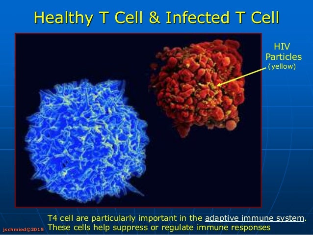 HIV AIDS presentation