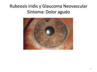 Retinopatía Diabética. Diabetic Retinopathy | PPTX