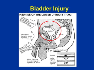 urethrography | PPT